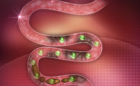 老年性便秘的症状