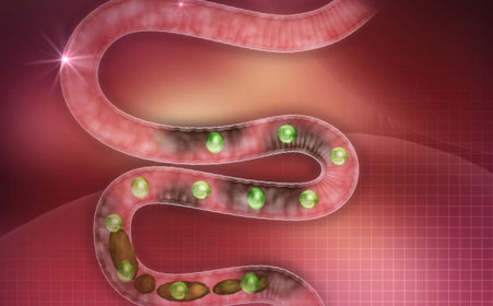 便秘的类型有哪几种