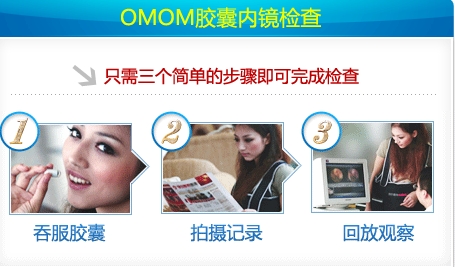 OMOM交囊内镜检查步骤